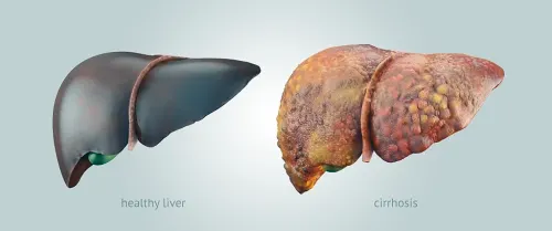 Stem Cell therapy for liver