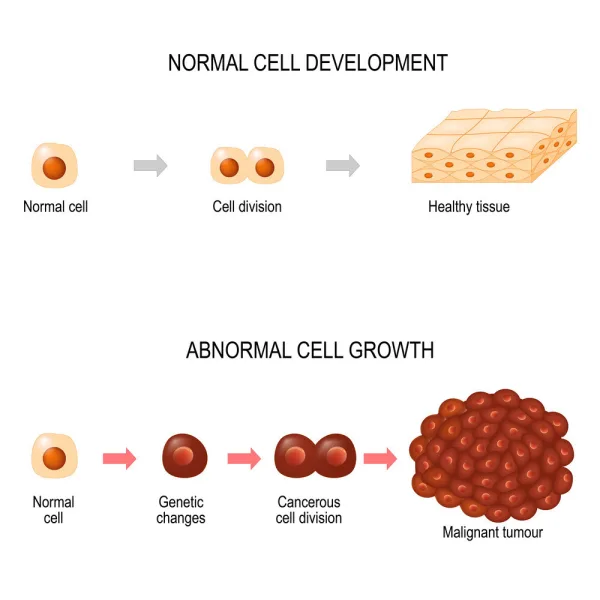 Stem cell therapy for cancer