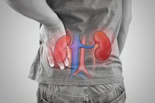 chronic-kidney