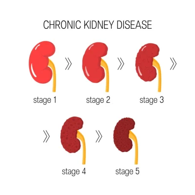 chronic-kidney-Overview